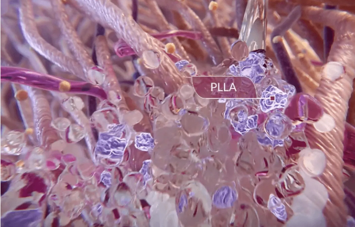 PLLA童颜针成分OEM贴牌：再生抗衰赛道的百亿级新机遇